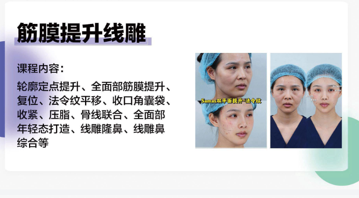 轻医美线雕课程